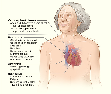 coronary-artery-disease